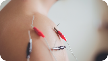 Electro acupuncture application